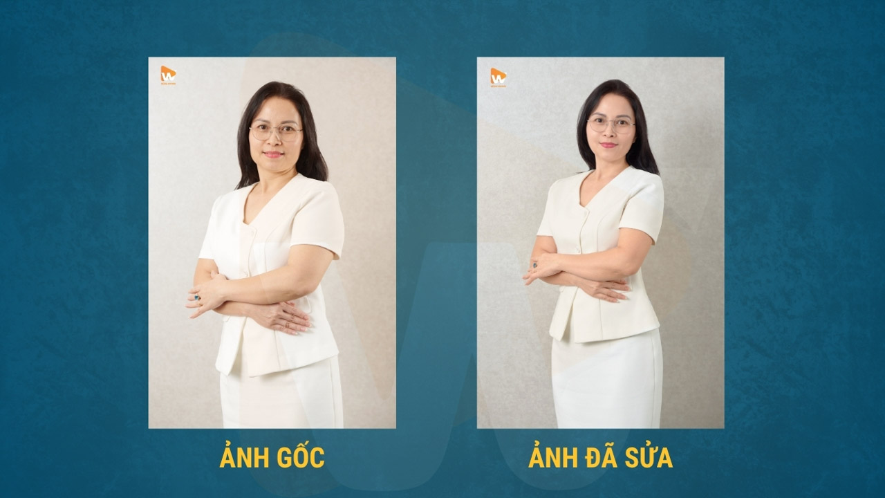 So sánh before và after retouch chân dung profile, giữ nét da tự nhiên, chỉ làm sạch và cân, chụp ảnh CV chuyên nghiệp cần chuẩn bị gì | Media WinWin