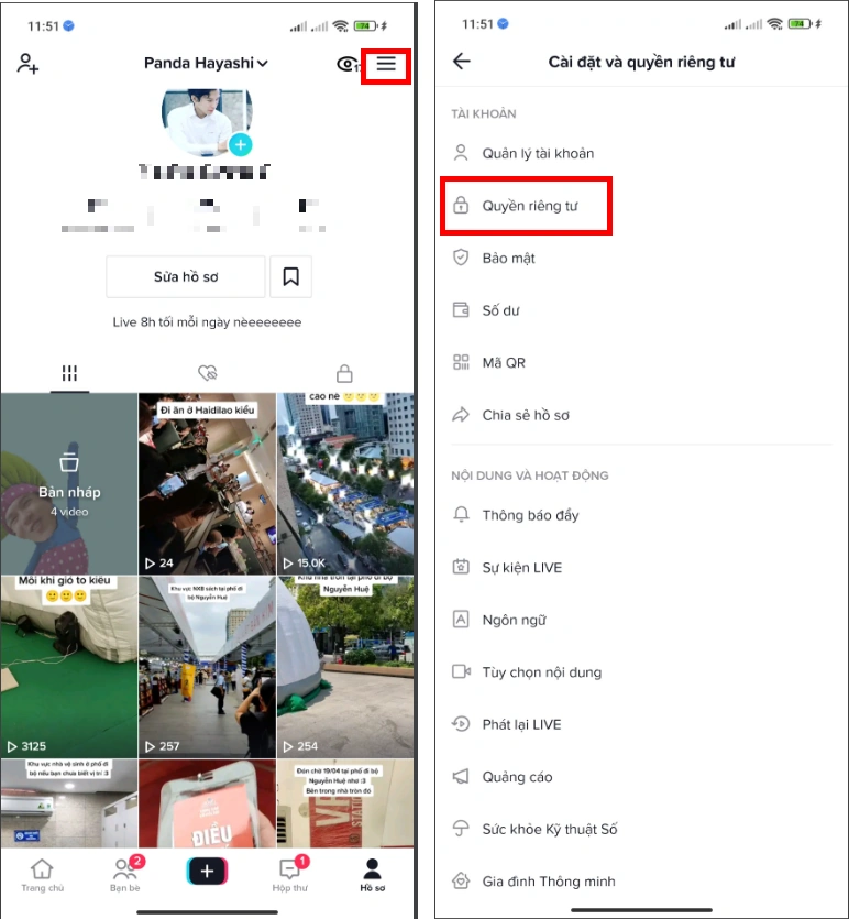 Thiết lập trước khi đăng video Tik Tok